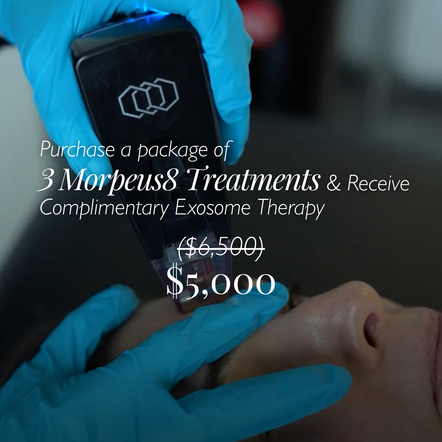 MORPHEUS8 TREATMENT SERIES + COMPLIMENTARY EXOSOME THERAPY