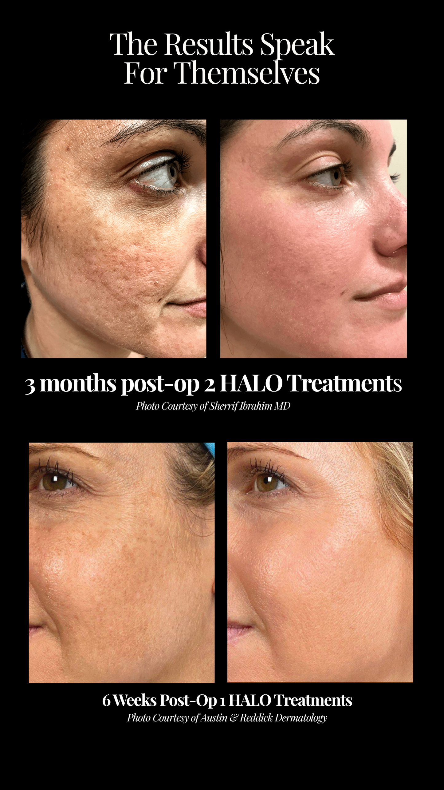 HALO FACE & NECK COLLECTION